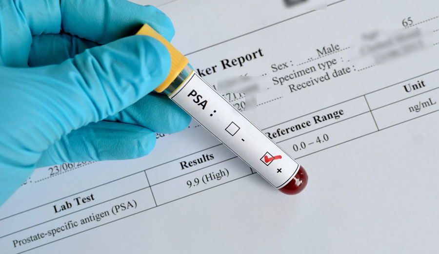 PSA Blood Testing at Deverell Hall Saturday 26th November 2022